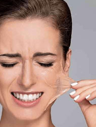 chemical peel treatment