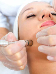 dermabrasion