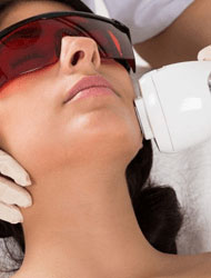 Laser Hair Removal Treatment