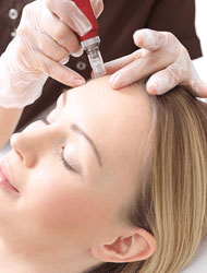 Mesotherapy Treatment