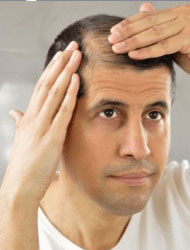 Hair Loss Treatment