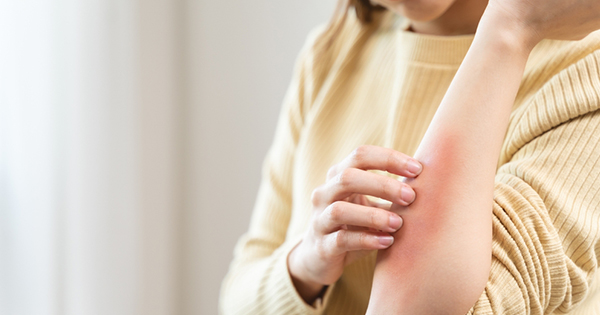 Monsoon tips by best dermatologist in Vijayawada